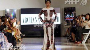 Modelo desfigurada por ácido abrió la Fashion Week de Nueva York