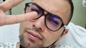 Jav Jurado sufrió una parálisis facial