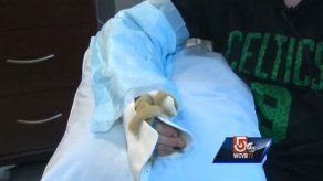 EEUU: Adolescente logra mover brazo reimplantado