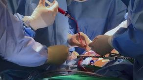 ¡Excelente noticia! CSS realiza más de 800 intervenciones cardiovasculares en solo dos meses