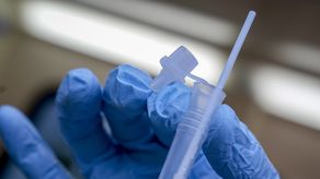 Aunque en Alemania la tasa de contagio no es tan alta como en otras naciones europeas, su incesante aumento ha hecho saltar las alarmas.