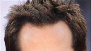 Cinta de Ben Stiller causa ira en grupos de discapacitados