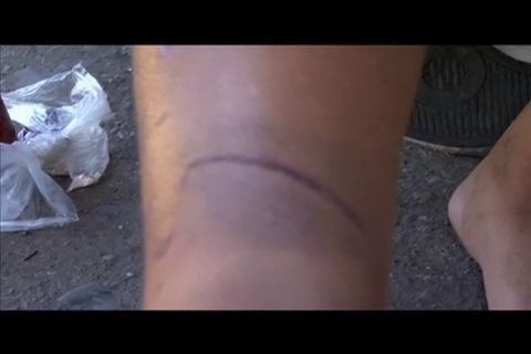 Menor de edad es maltratado por diablico sucio en Bocas del Toro