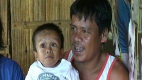 El hombre más pequeño del mundo