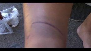 Menor de edad es maltratado por diablico sucio en Bocas del Toro