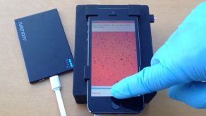 Un microscopio de teléfono móvil puede detectar parásitos en gota de sangre