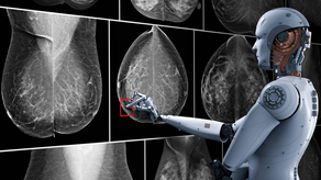 ¡Esperanza! Inteligencia Artificial aportaría a detectar el cáncer de mama