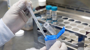 Minsa asegura que cepa Beijing de tuberculosis en Colón está bajo control