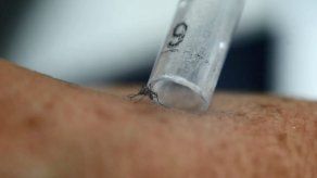 La primera vacuna contra el zika no estará lista antes de tres años