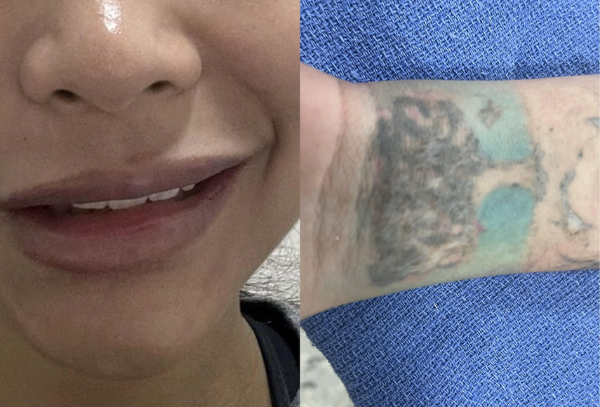 Desmantelan supuesta estética en Bella Vista