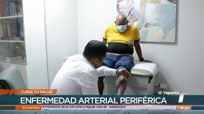 Cuida tu Salud: Enfermedad arterial periférica