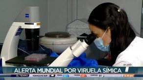 Autoridades de salud costarricenses descartan caso de viruela símica
