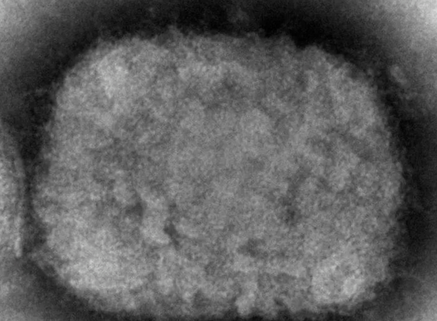 Diez infecciones con viruela símica han sido confirmadas en Estados Unidos.