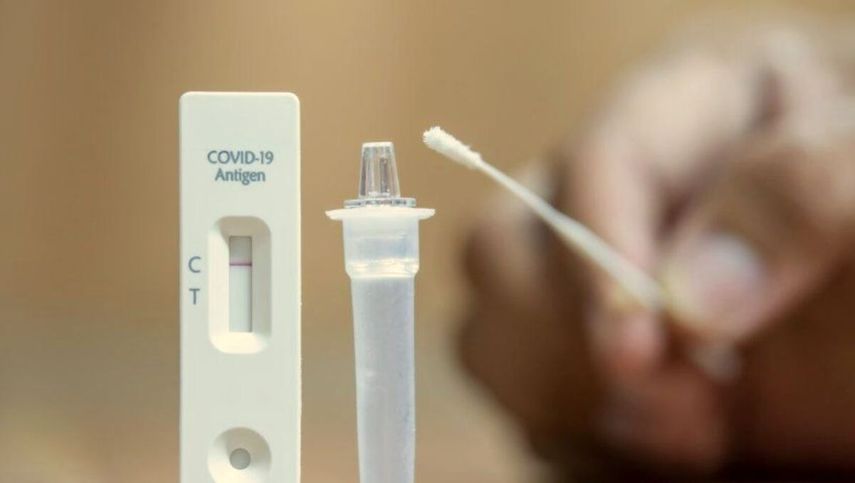 El Instituto Gorgas indicó que las pruebas que cuentan con registro sanitario en el país tienen uso y alcances distintos a Standard Q COVID-19 Ag Home Test y a la Estándar Q COVID-19 Ag Test.