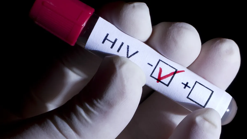 MINSA: Los jóvenes de 19 a 29 años son los grupos con más casos de VIH