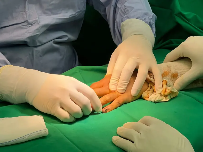 CSS realiza cirugía en Veraguas y devuelve movilidad a un joven.