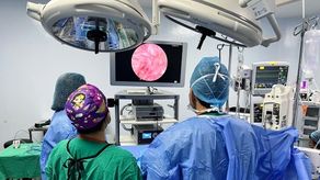 Agregó que esta es una cirugía avanzada en patología de alta complejidad, que mejora grandemente la vida del paciente y es la primera vez que se realiza en el país.