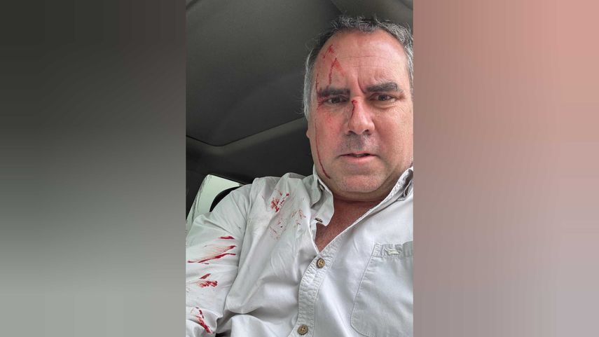 Gino Costa compratió en la red social X imágenes del atentado al candidato a la presidencia.