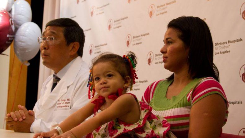 Doctores de EEUU aseguran operación de siamesa panameña