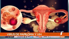 Autoridades instan a las mujeres a realizarse prueba de papanicolau