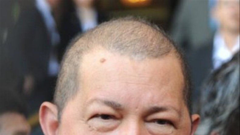 EEUU considera horribles declaraciones de Chávez sobre cáncer