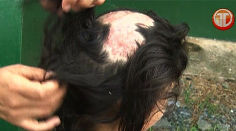 Menor perdió el cabello por proliferación de palomas en escuela de Arraiján