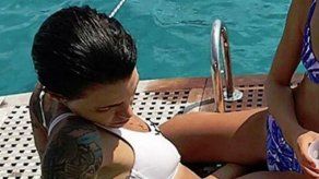 Ruby Rose sufre una picadura de una medusa en Ibiza