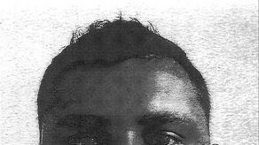 EE.UU: Técnico de laboratorio acusado de brote de hepatitis C