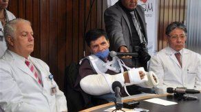 México anuncia primer trasplante de brazos en Latinoamérica