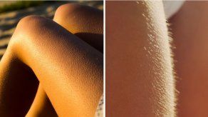 ¿Por qué se nos pone la piel de gallina?