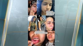 Las jóvenes brindaron detalles sobre cómo ocurrió la agresión.