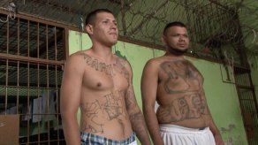 Borrarse los tatuajes