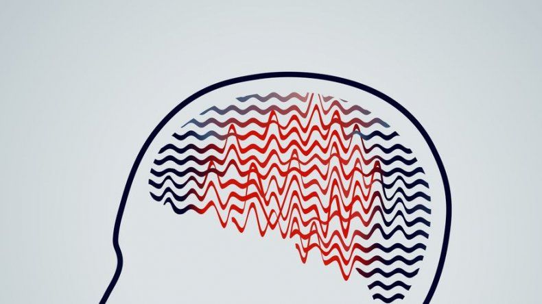 Investigador colombiano crea software para ubicar focos de ataques epilepsia