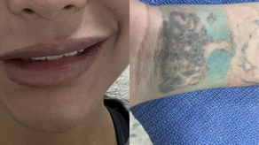 Desmantelan supuesta estética en Bella Vista