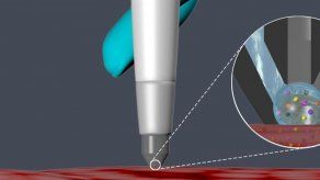 Crean herramienta que podría usarse para identificar el cáncer
