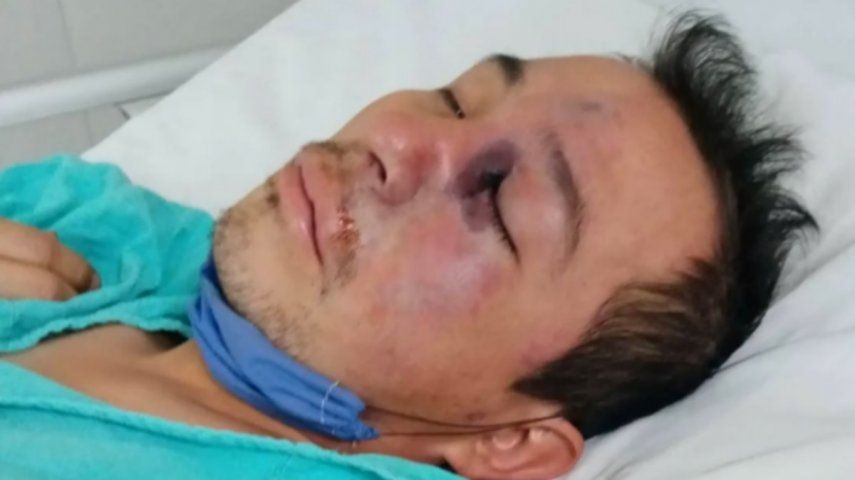 Hongo Negro en México: Gregorio tiene 34 años