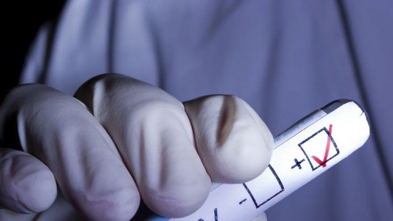 Ciudad rusa tiene epidemia de VIH
