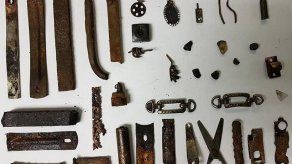 Cirujanos extraen 32 objetos metálicos del estómago de un cubano