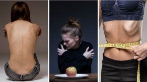 ¿Cómo afecta a las mujeres el fantasma de la anorexia?