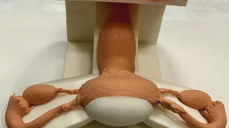 La tecnología de impresión tridimensional revoluciona la cirugía