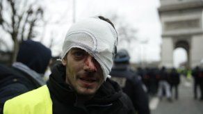 Primeros brotes de violencia entre policías y los chalecos amarillos