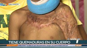 Familiares de menor que sufrió quemaduras de tercer grado solicitan apoyo para cubrir gastos en EE. UU.