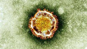 Otros dos muertos por coronavirus en Arabia