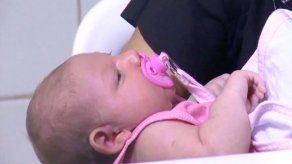 Cuatro casos de microcefalia asociados al zika se han registrado en Panamá