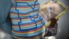 Casos de microcefalia asociados al zika causan alarma en Centroamérica