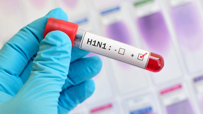 H1N1 circula nuevamente en Panamá