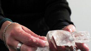 Londres creará un registro nacional de implantaciones de prótesis mamarias