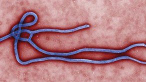 España anuncia una ayuda económica a Guinea Conakry por brote de ébola