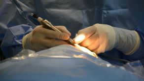 Investigan presunto pago de cirugías bariátricas&nbsp;