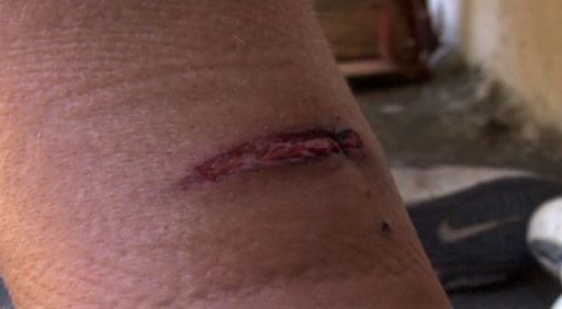 Menor de edad es maltratado por diablico sucio en Bocas del Toro